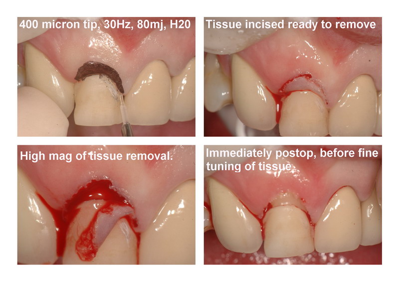 RR patient page 3_resize.jpg